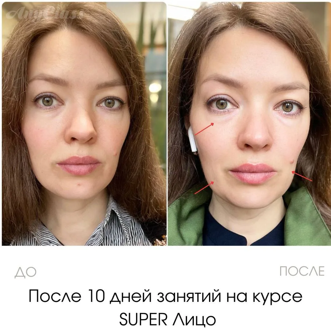 Каждая история и результат моих учениц уникальная по-своему   В этом и прелесть гимнастики для лица 