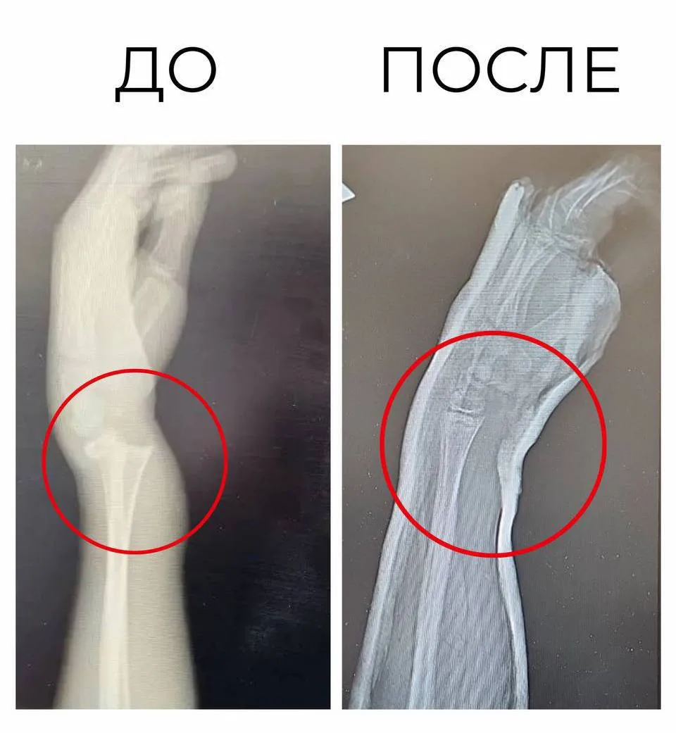 Упал с дерева и покусала собака — такой итог неудачного свидания для школьника из Подмосковья.  👩‍❤️