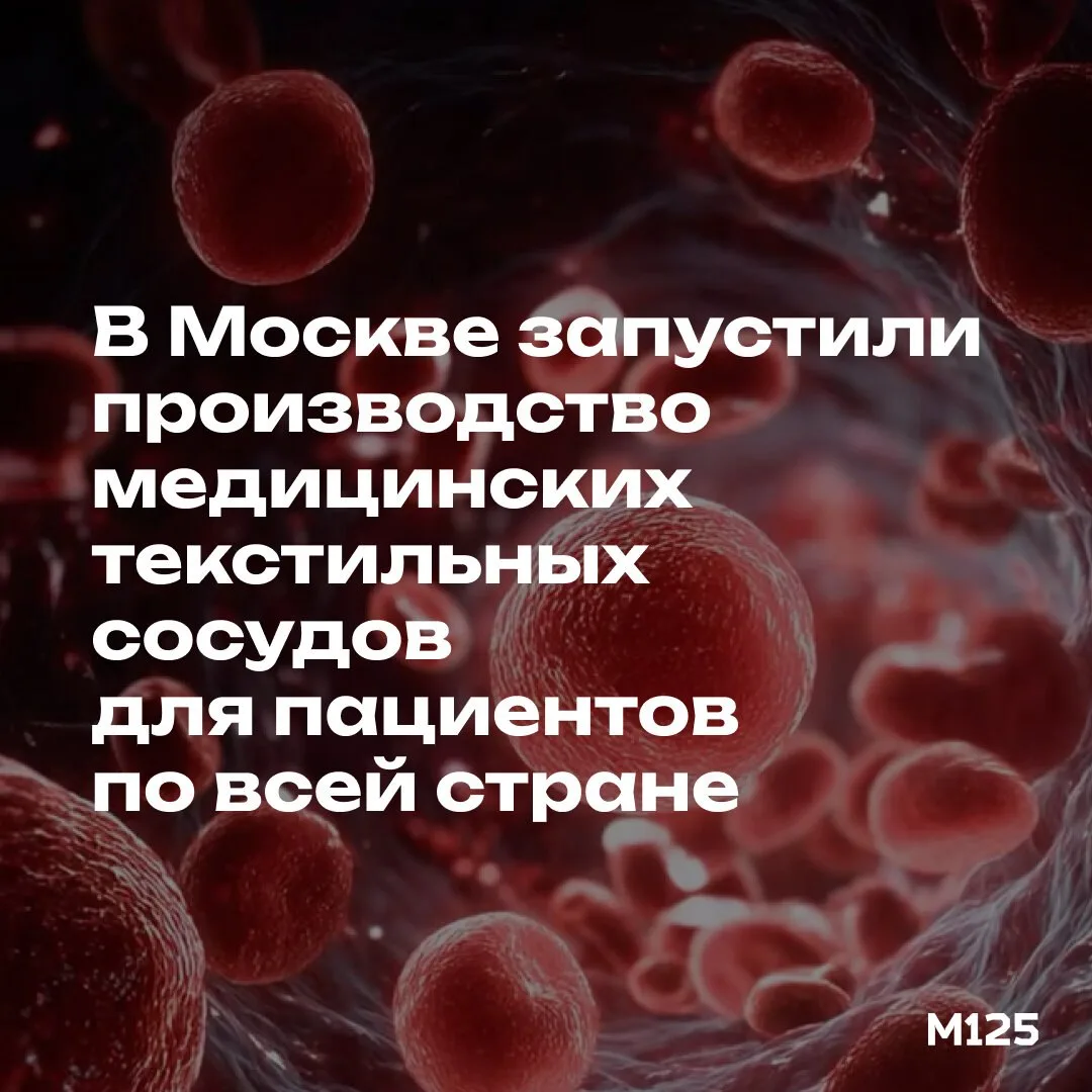 В Москве начали выпускать сосудистые протезы, которые нужны пациентам по всей стране.