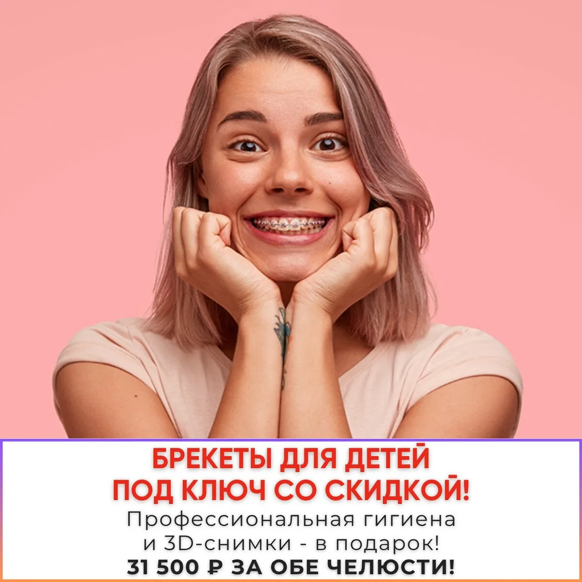 Брекеты для детей до 16 лет. Цена за обе челюсти 31,500₽