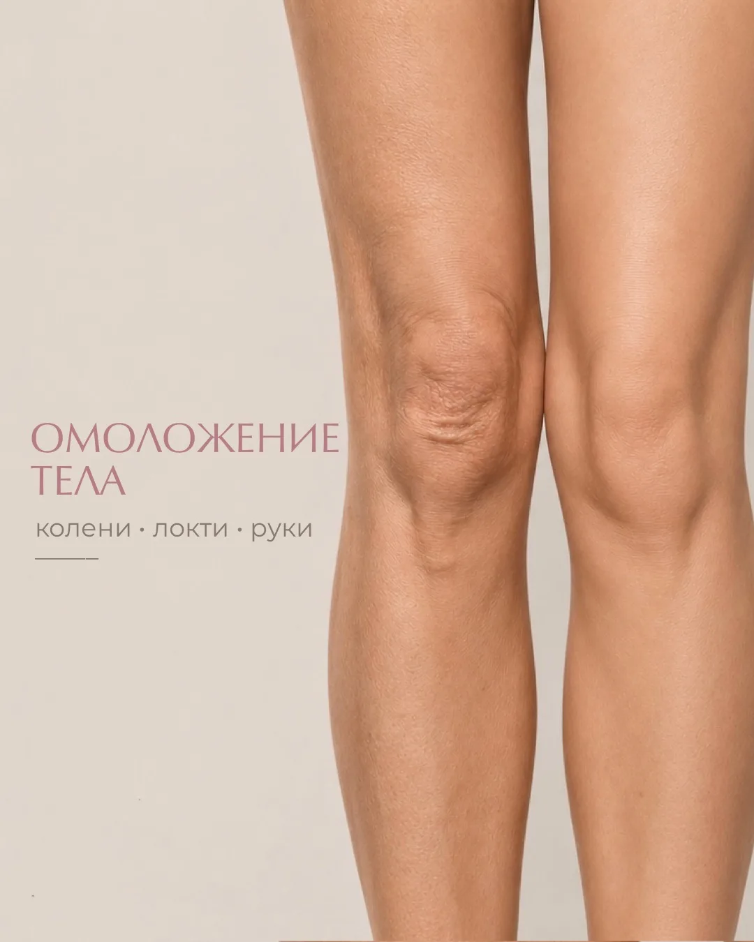 Колени, руки и локти - зоны, которые часто выдают возраст раньше лица.