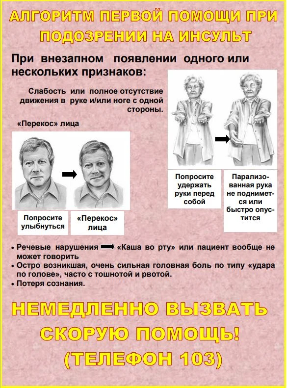 Скорая помощь при инсульте
Оказывая первую помощь дома или в любом другом месте, следует понимать, ч