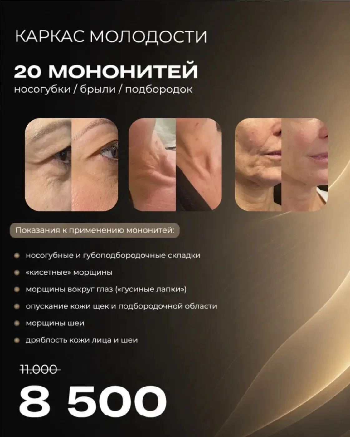 🖇️ КАРКАС МОЛОДОСТИ🖇️