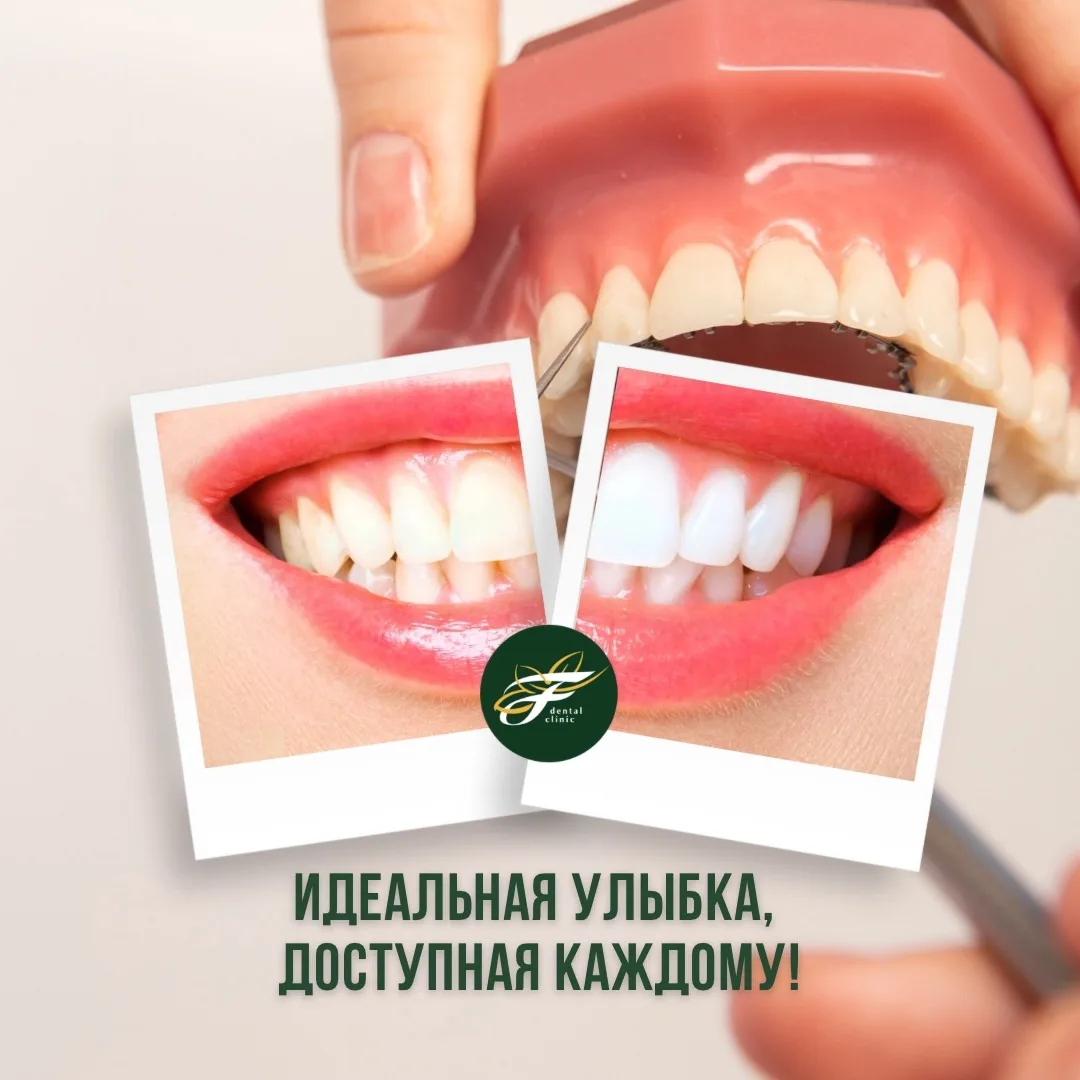 Идеальная улыбка сегодня — это сочетание здоровья, эстетики и современных технологий, к...