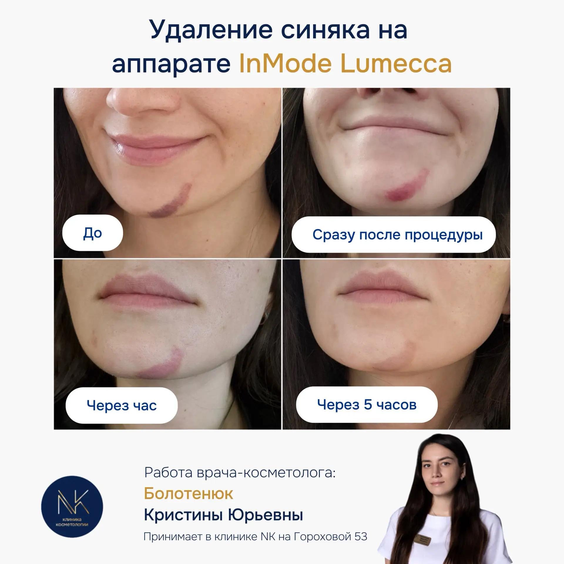 💣Такой результат мы показываем впервые!