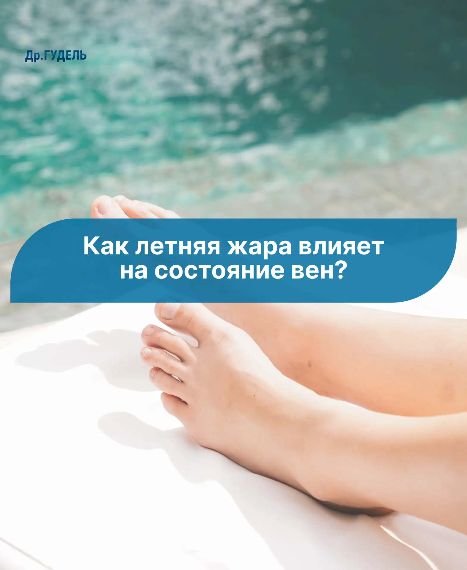 Как летняя жара влияет на состояние вен?