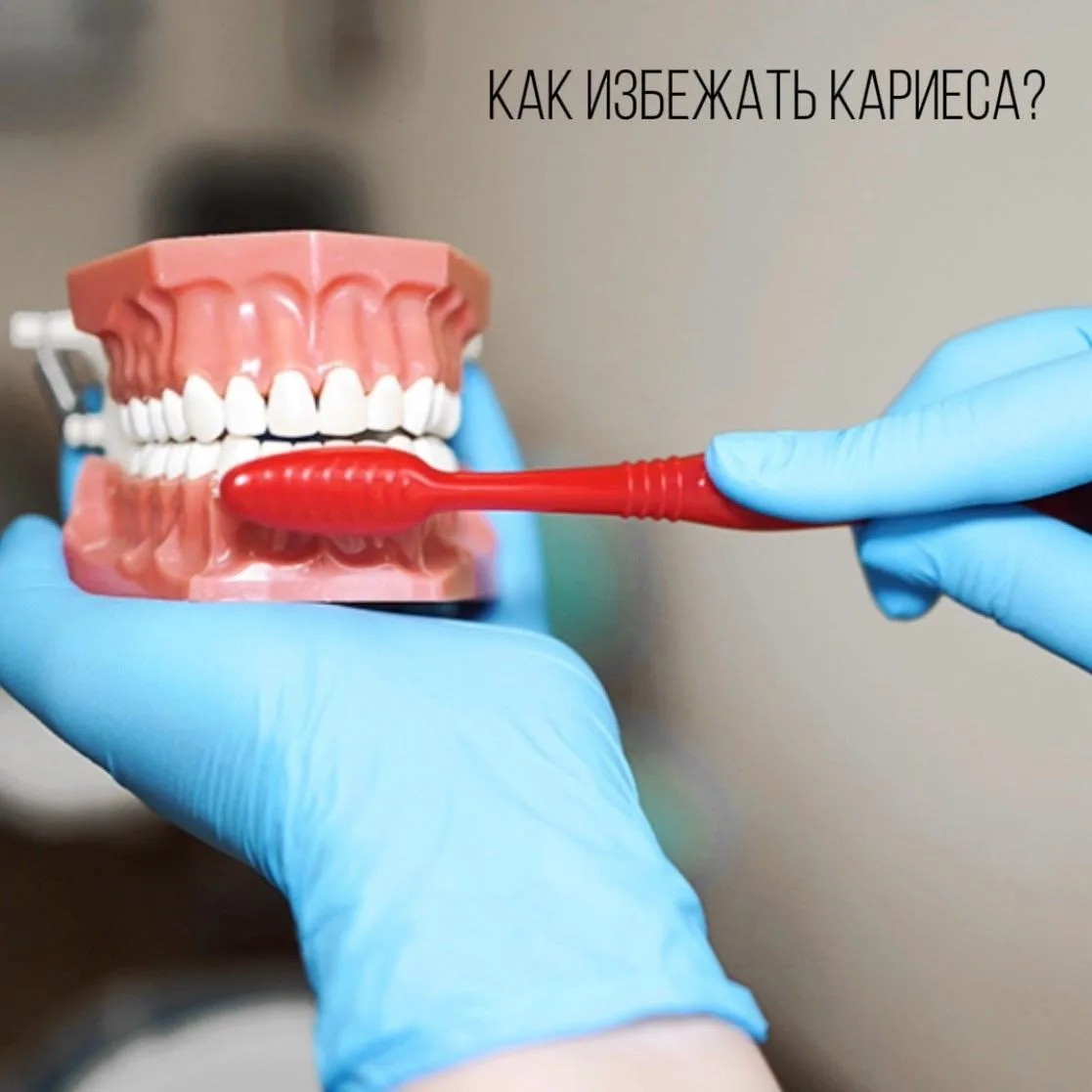Как избежать кариеса.