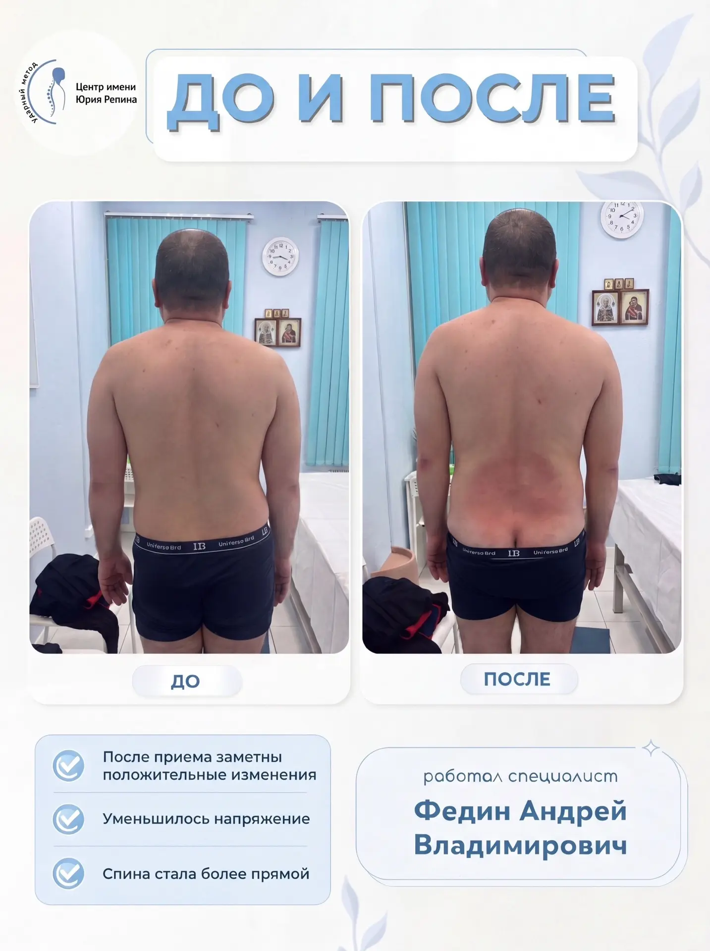 ДО И ПОСЛЕ. Видимый результат