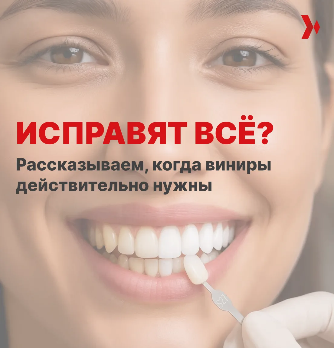 Когда нужна установка виниров?