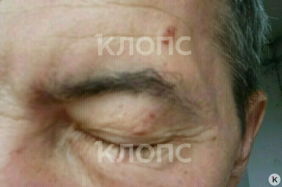 «Меня схватили за волосы и начали бить»: на променаде в Зеленоградске произошёл конфлик...