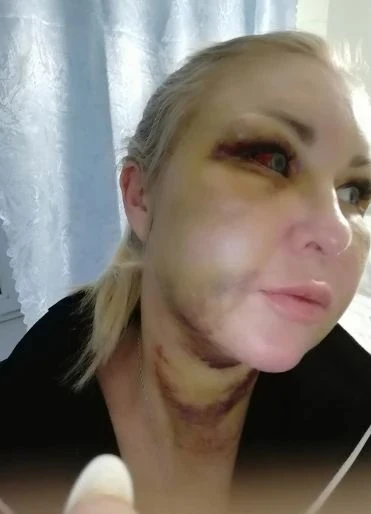 ❗️В Черниковке из-за мужчины жестоко избили многодетную мать