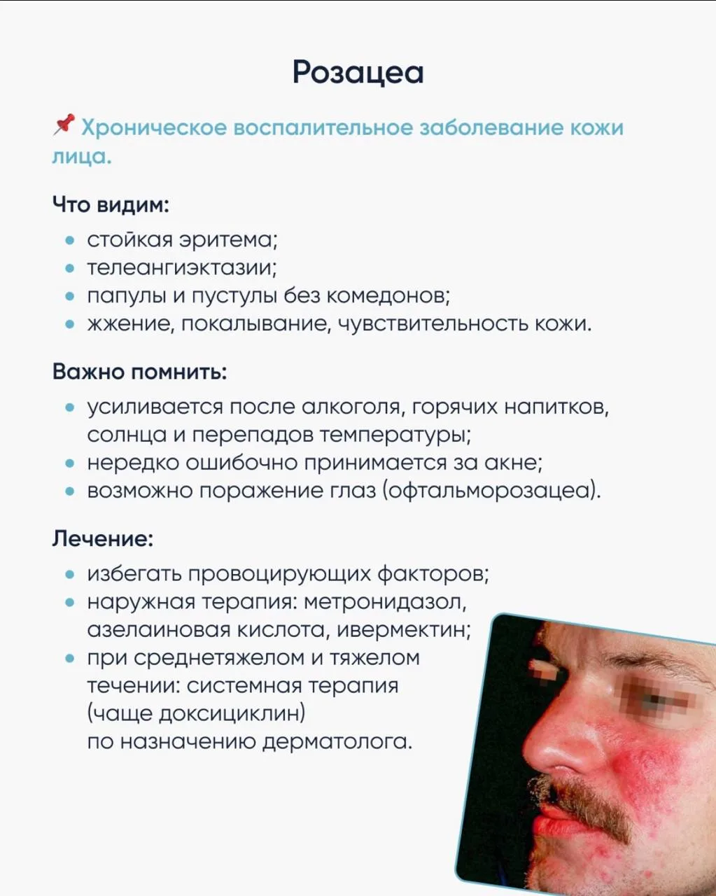 🫧 5 кожных заболеваний, о которых должен знать врач