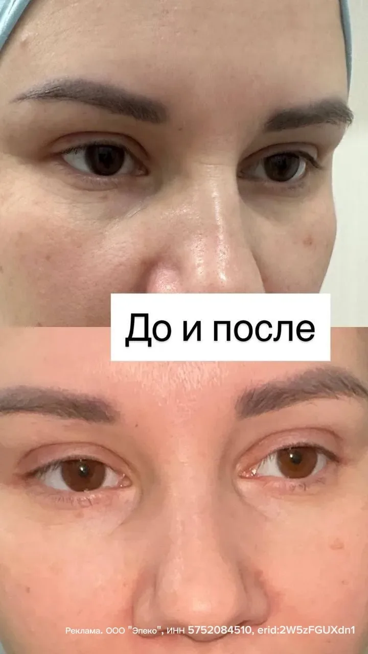 Изображение 1 к публикации «ЭЛЬМИРА КАМАЛИЕВА»