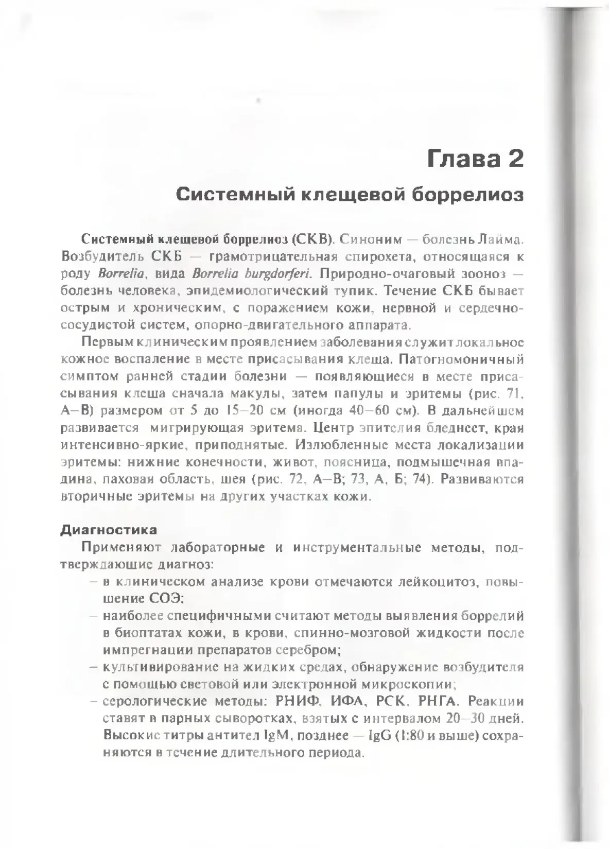 Системный клещевой боррелиоз