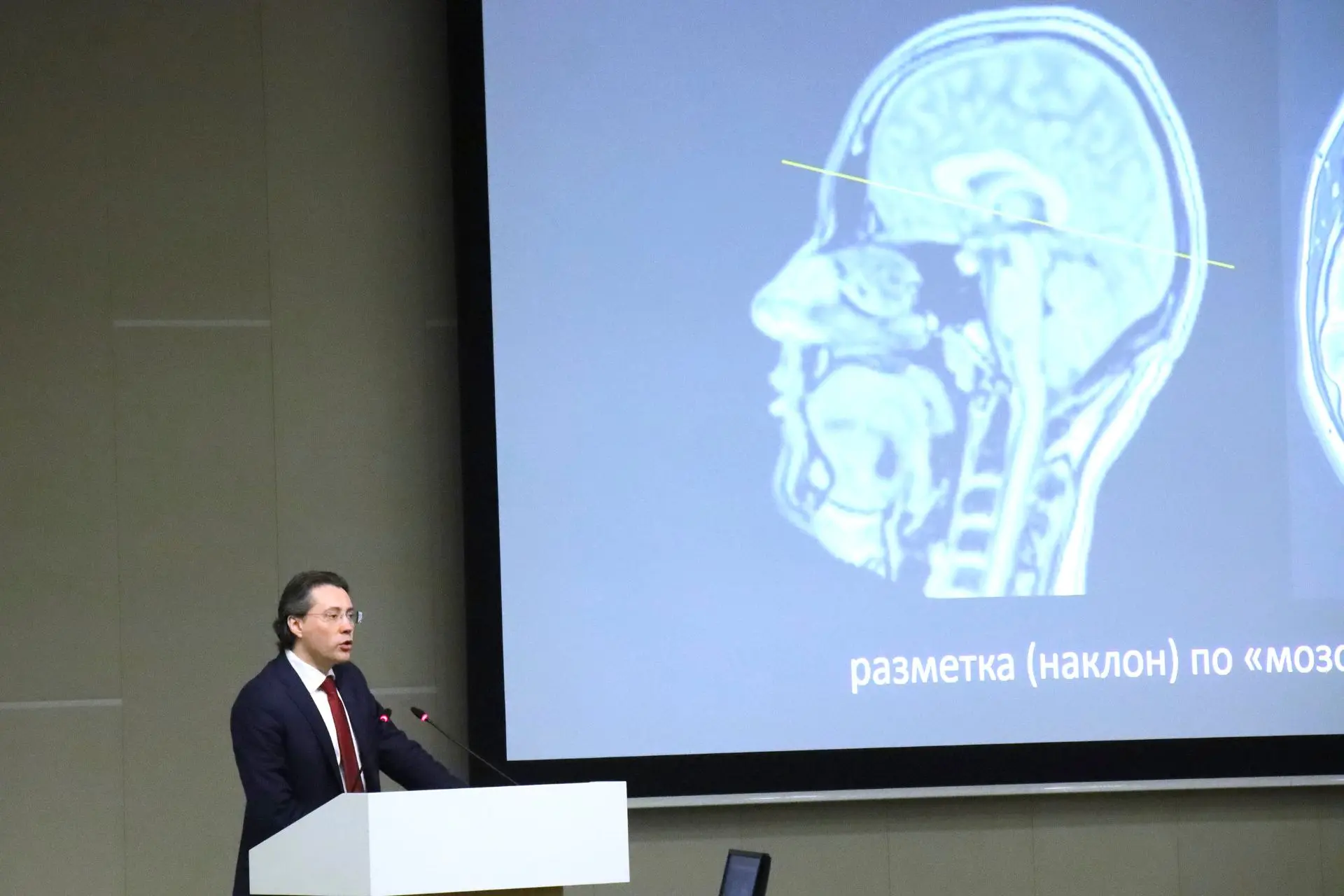23 января 2026г в ФГАУ «НМИЦ нейрохирургии им. ак. Н.Н. Бурденко» состоялась 25-я ежегодная научно-п