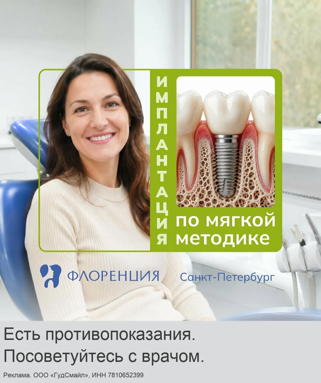 Имплантация зубов по мягкой методике в Санкт-Петербурге