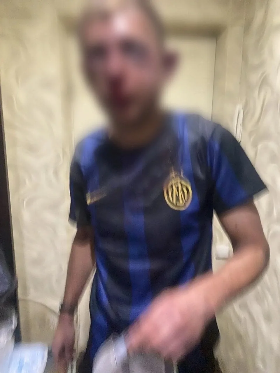На пляже Первого озера жестоко пострадал мужчина: ему была проведена операция

33-летний житель Челя
