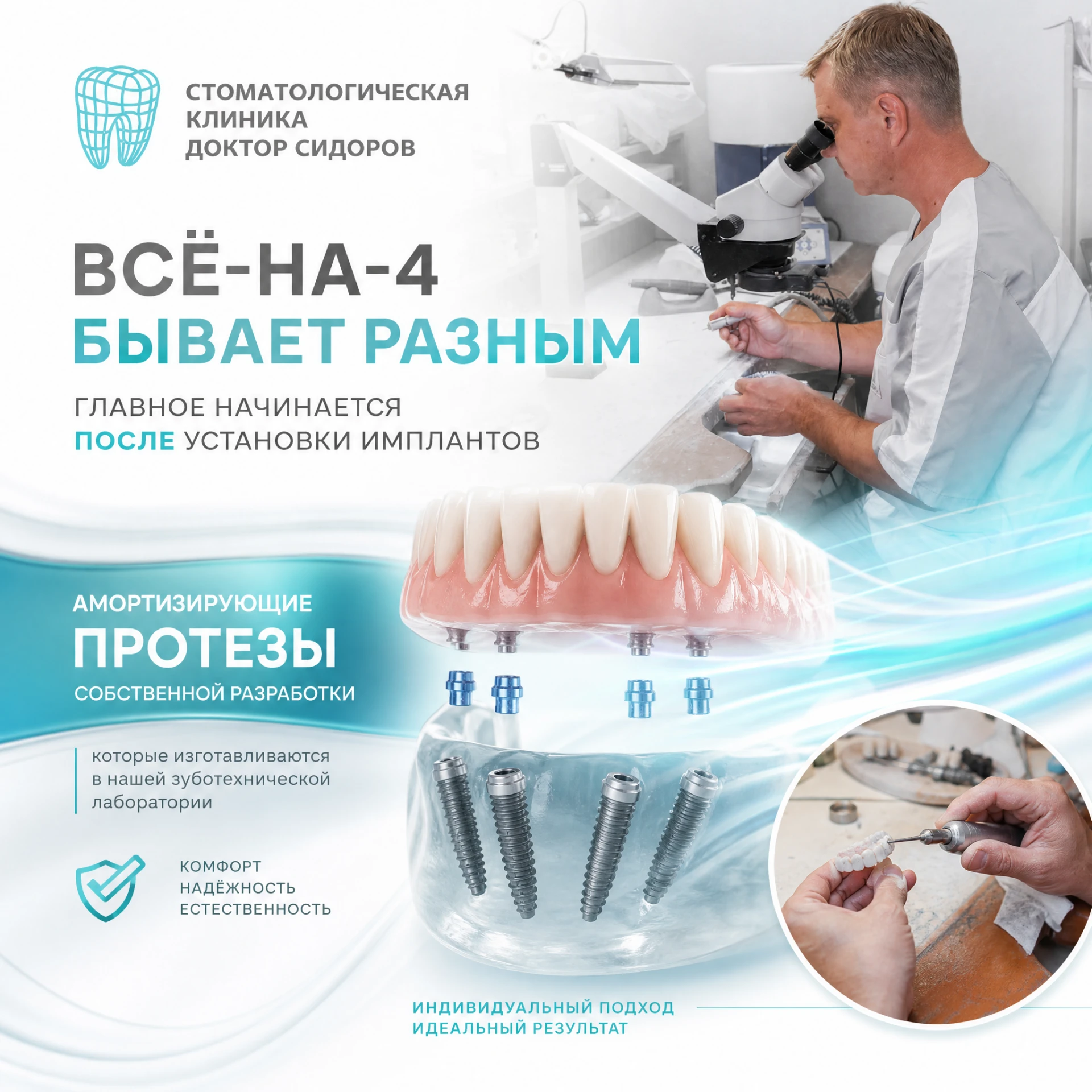 🦷 Всё-на-4 бывает разным. Главное начинается после установки имплантов