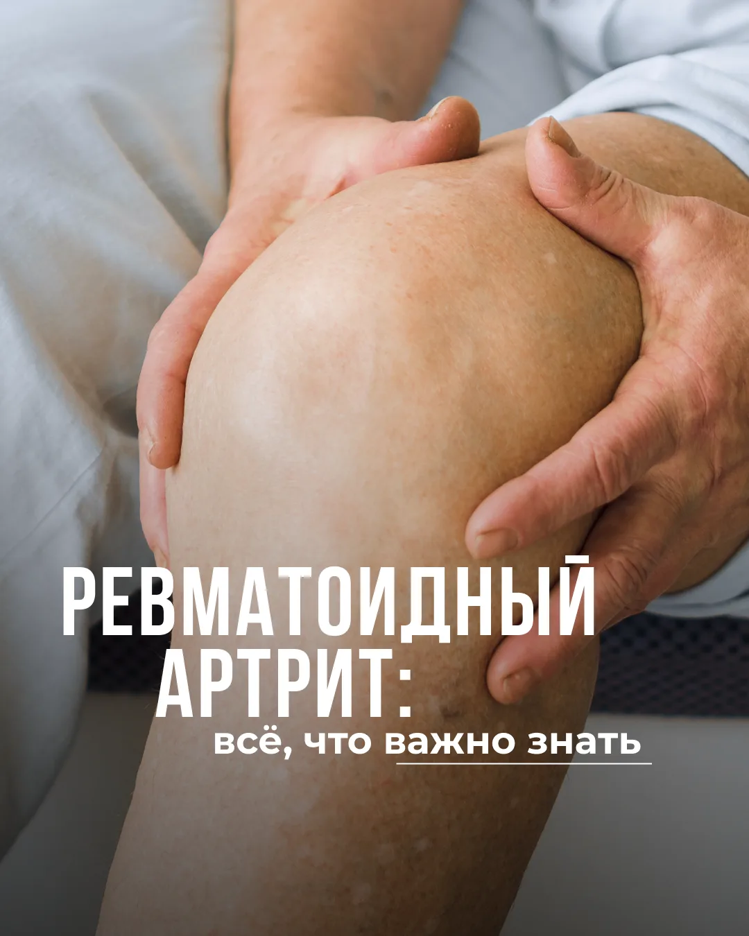 Ревматоидным артритом болеют около миллиона россиян старше 35 лет.