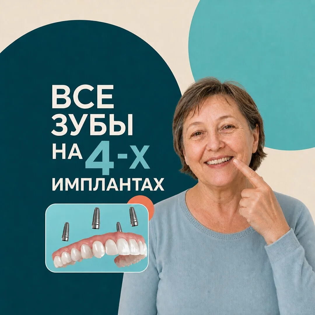 Все зубы на 4-х в Оренбурге: программа для пенсионеров!