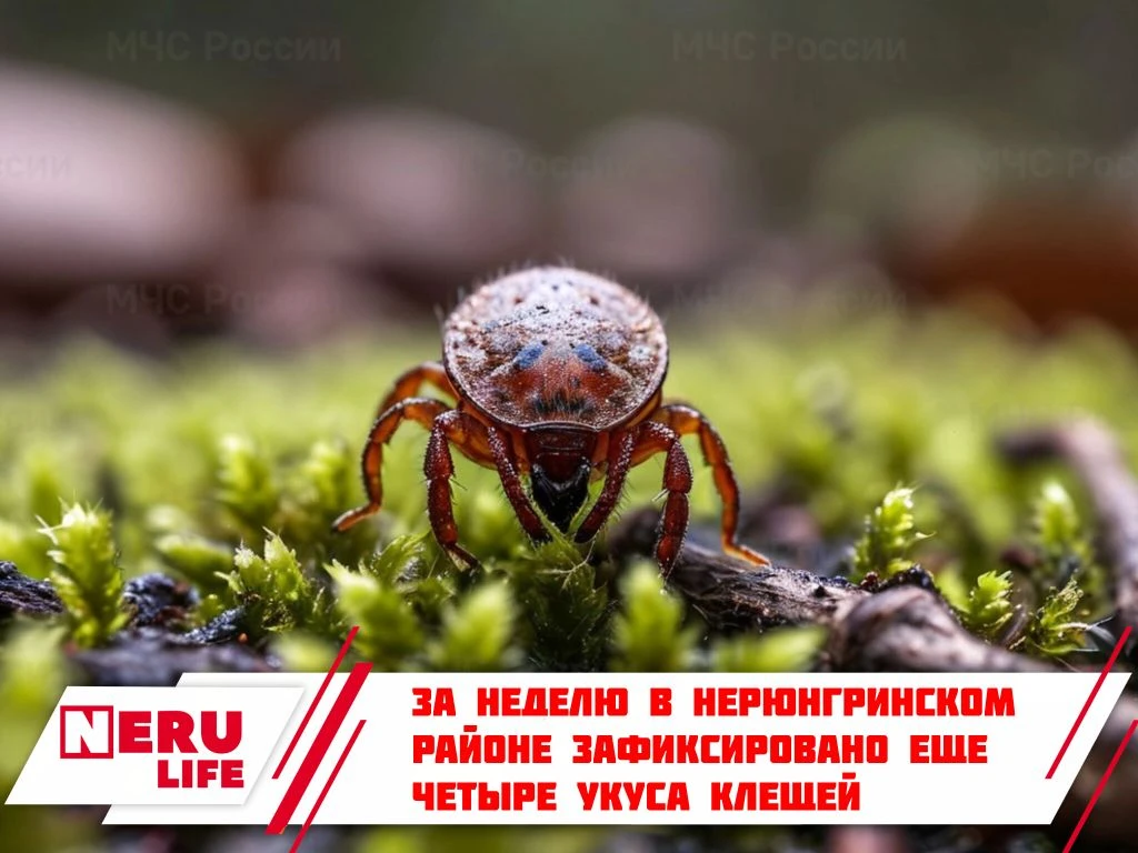 За неделю в Нерюнгринском районе зафиксировано еще четыре укуса клещей