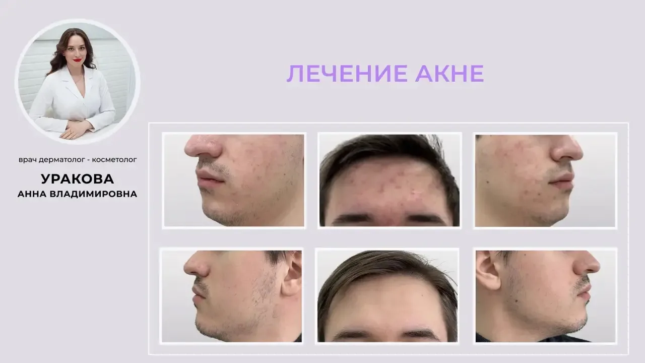 ✨ О волшебной палочке и чистой коже ✨