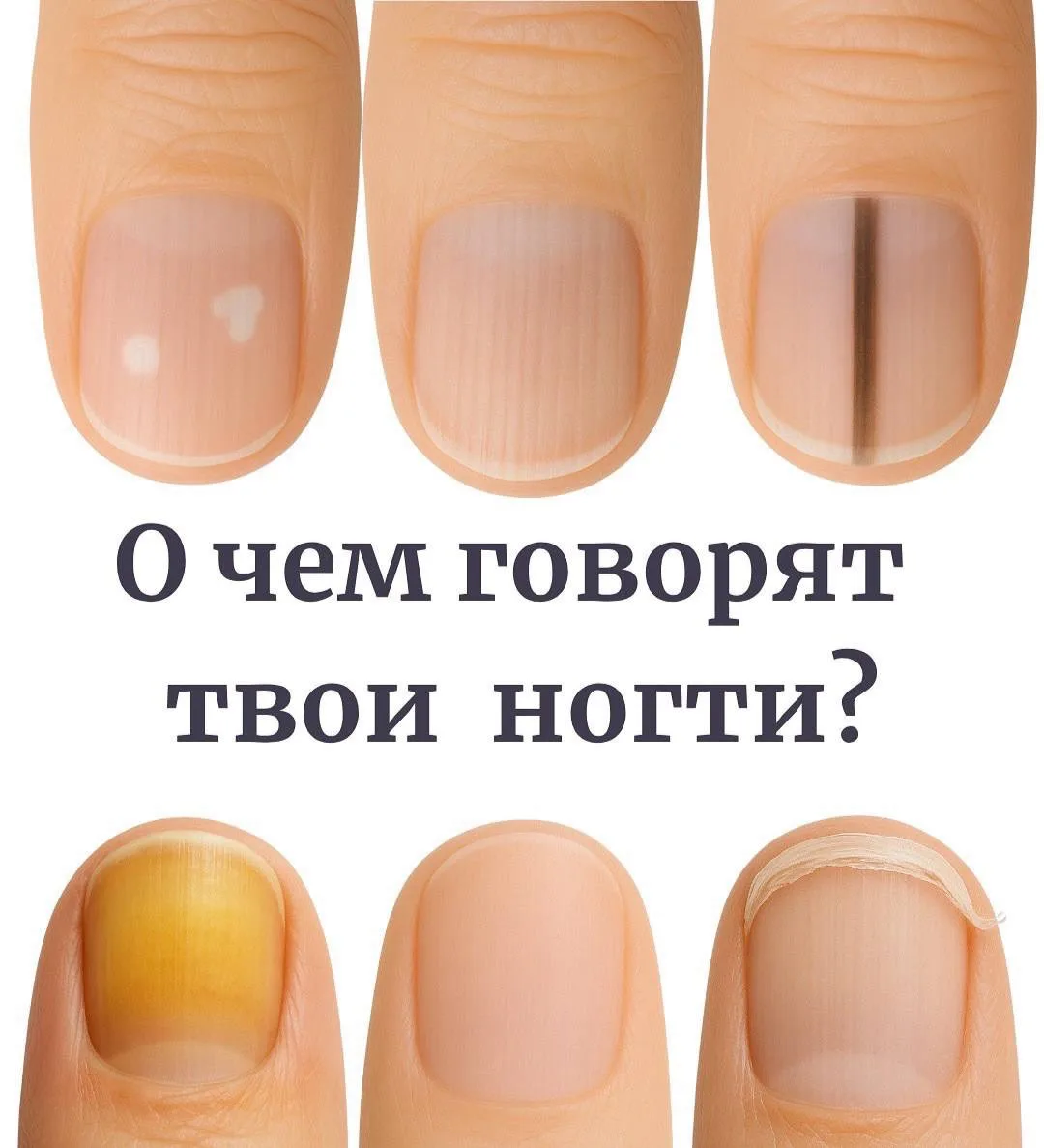 О чем говорят ваши ногти?