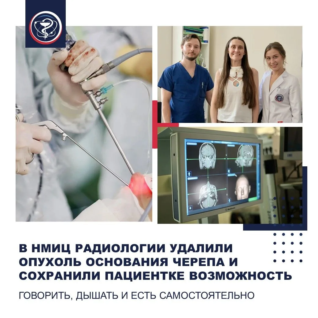В НМИЦ радиологии удалили опухоль основания черепа и сохранили пациентке возможность говорить, дышат