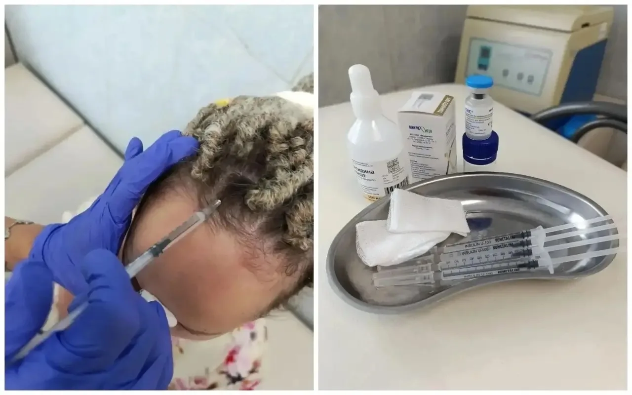 В Челябинске мигрень лечат «уколами красоты» по ОМС💉
