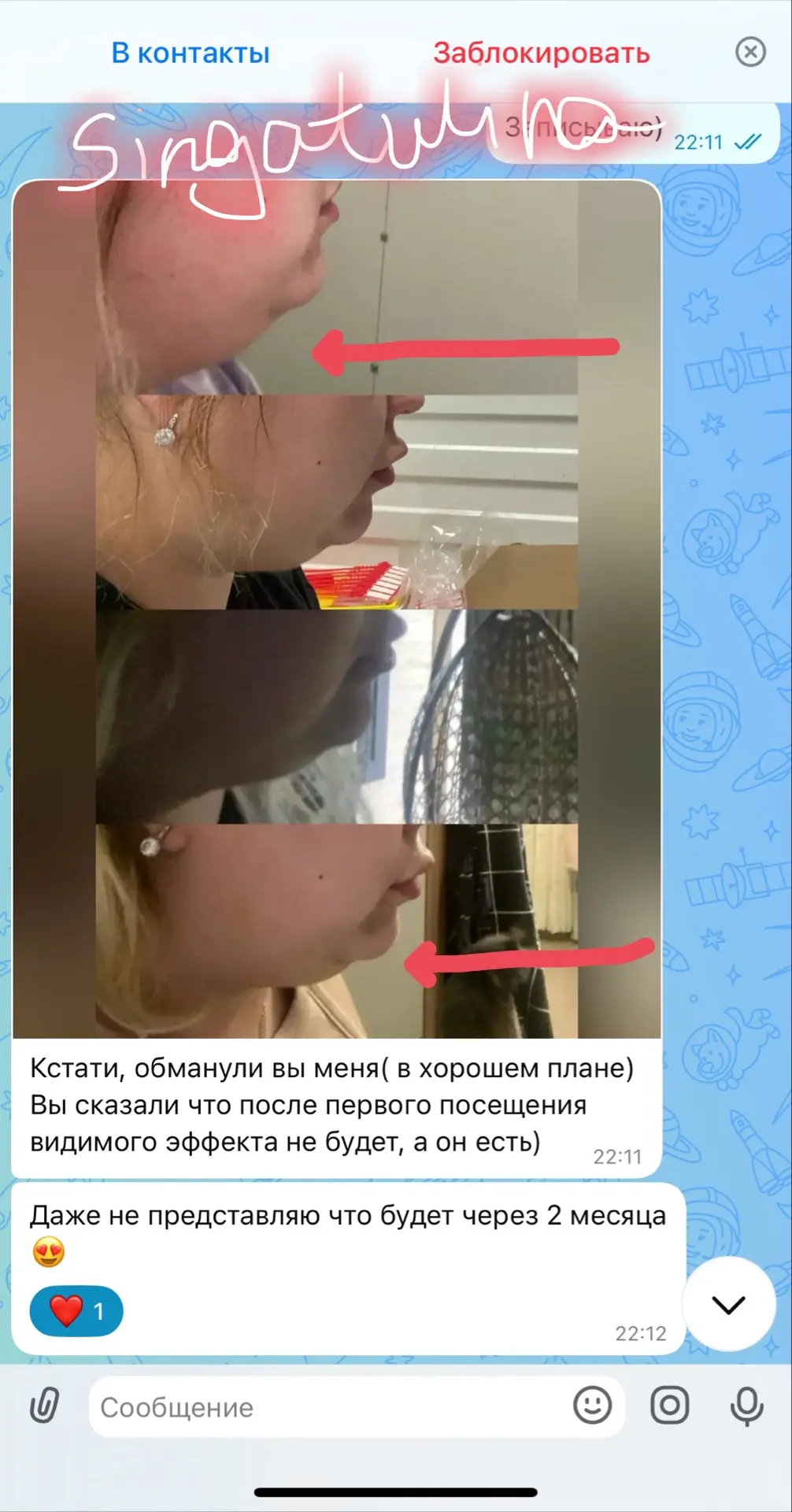 Результат после первой процедуры 🔥🔥🔥