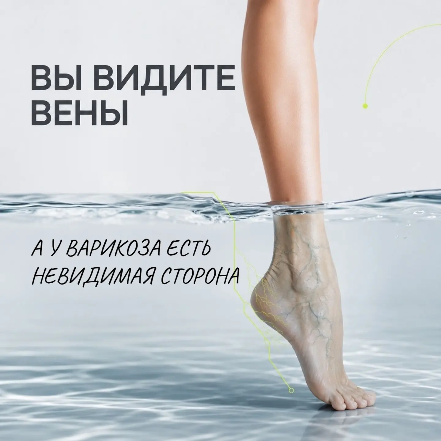 ✨Многие привыкли считать варикозное расширение вен исключительно эстетической проблемой.