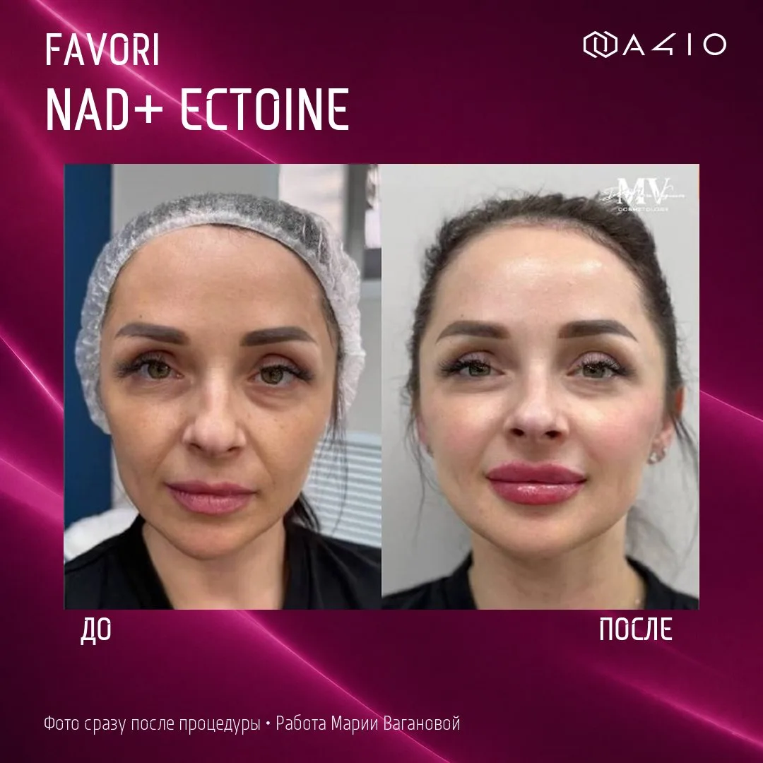 ✨ ДО/ПОСЛЕ с FAVORI NAD+ Ectoine