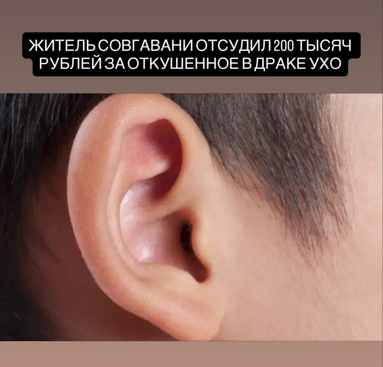 Житель Советской Гавани отсудил 200 тысяч рублей после драки, в которой лишился части уха

Суд в Сов
