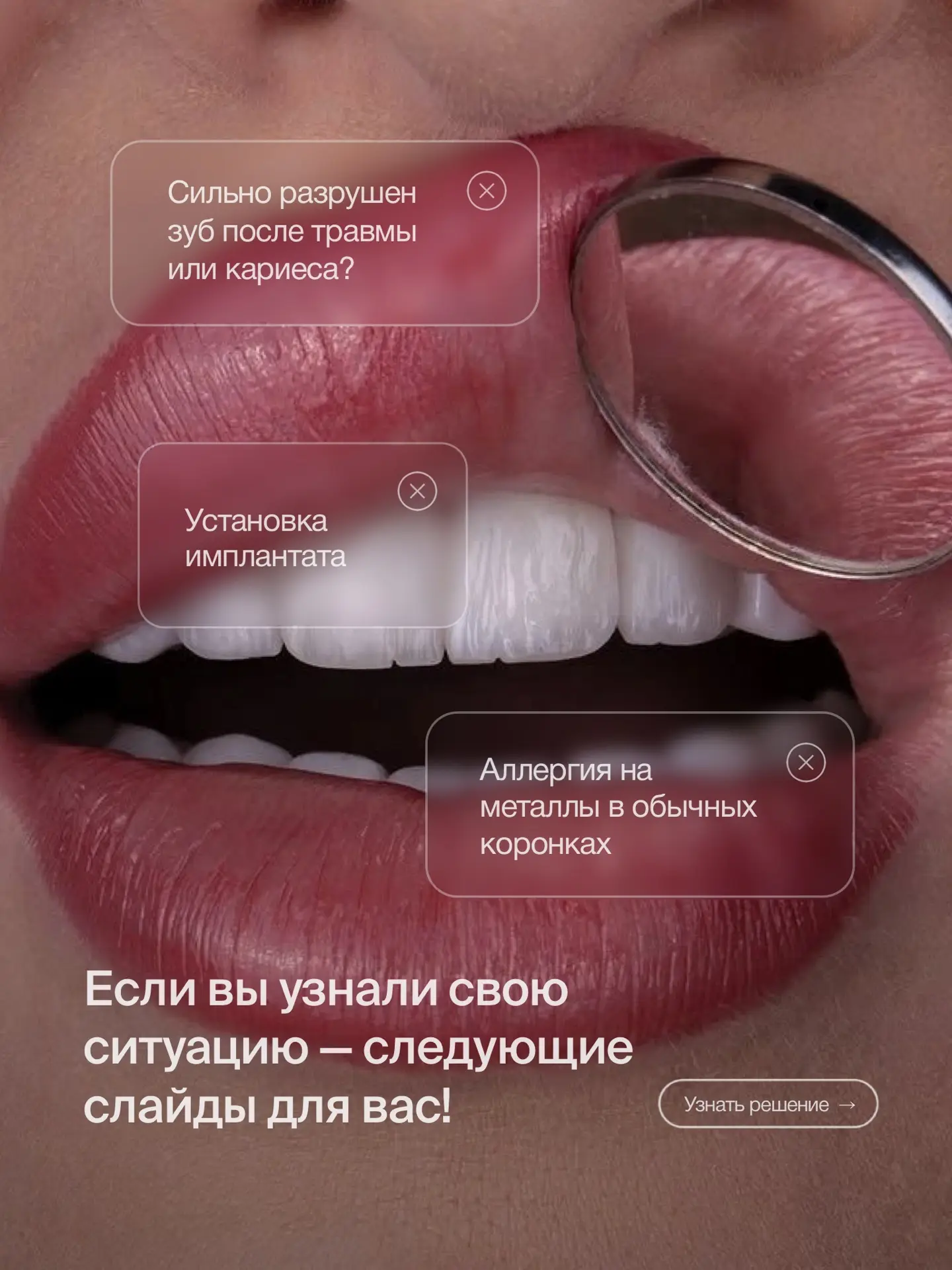 📌 ПОЧЕМУ СТОИТ ВЫБРАТЬ КОРОНКИ ИЗ ДИОКСИДА ЦИРКОНИЯ?