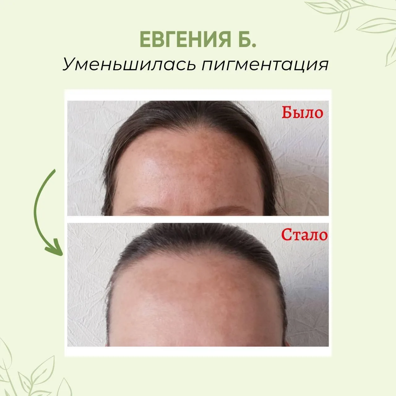 Красные родинки, пигментные пятна и высыпания на лице - почему косметолог не поможет?   Очень часто 