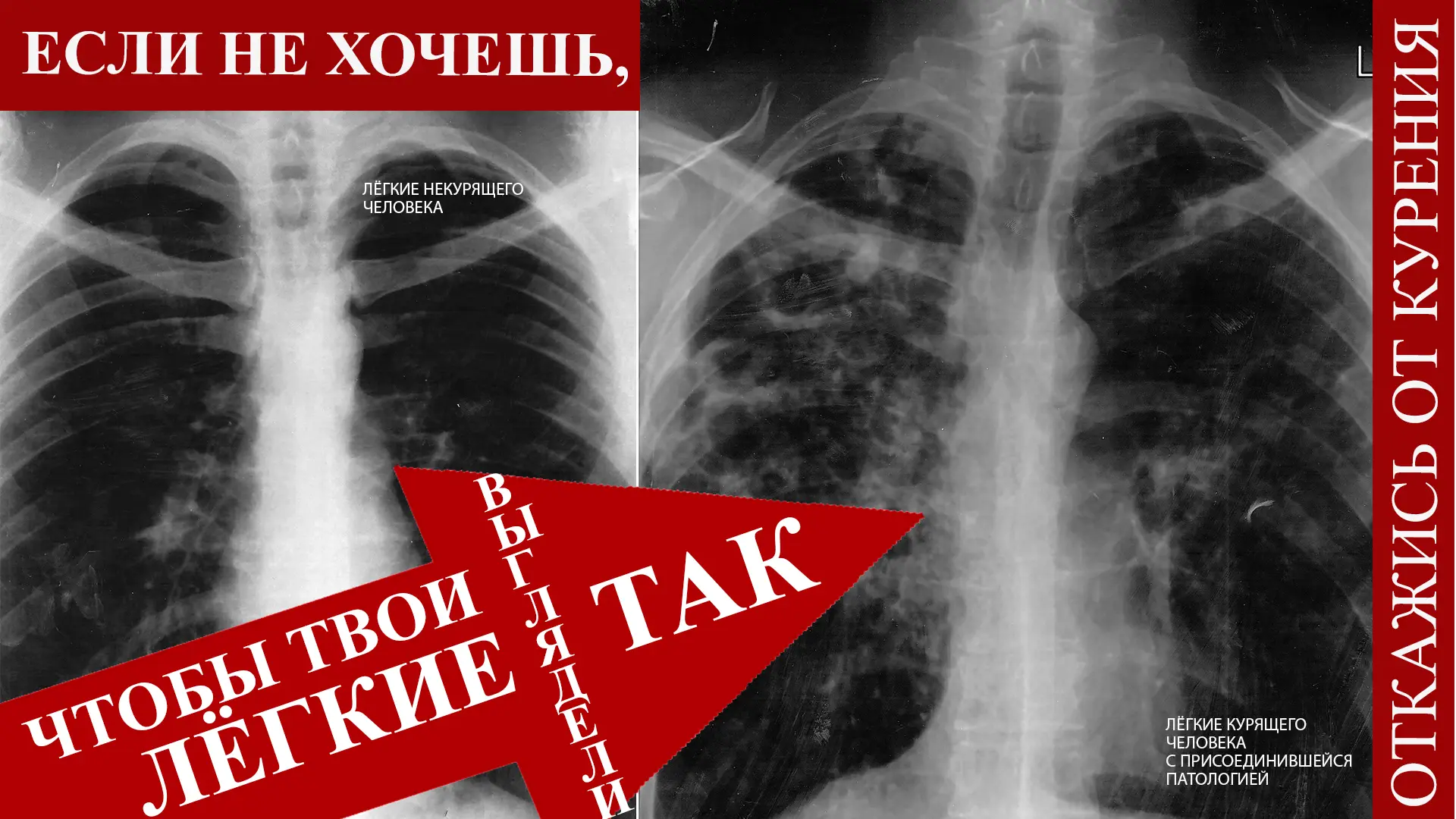 Информационные материалы по формированию профилактической среды, направленной на снижен...