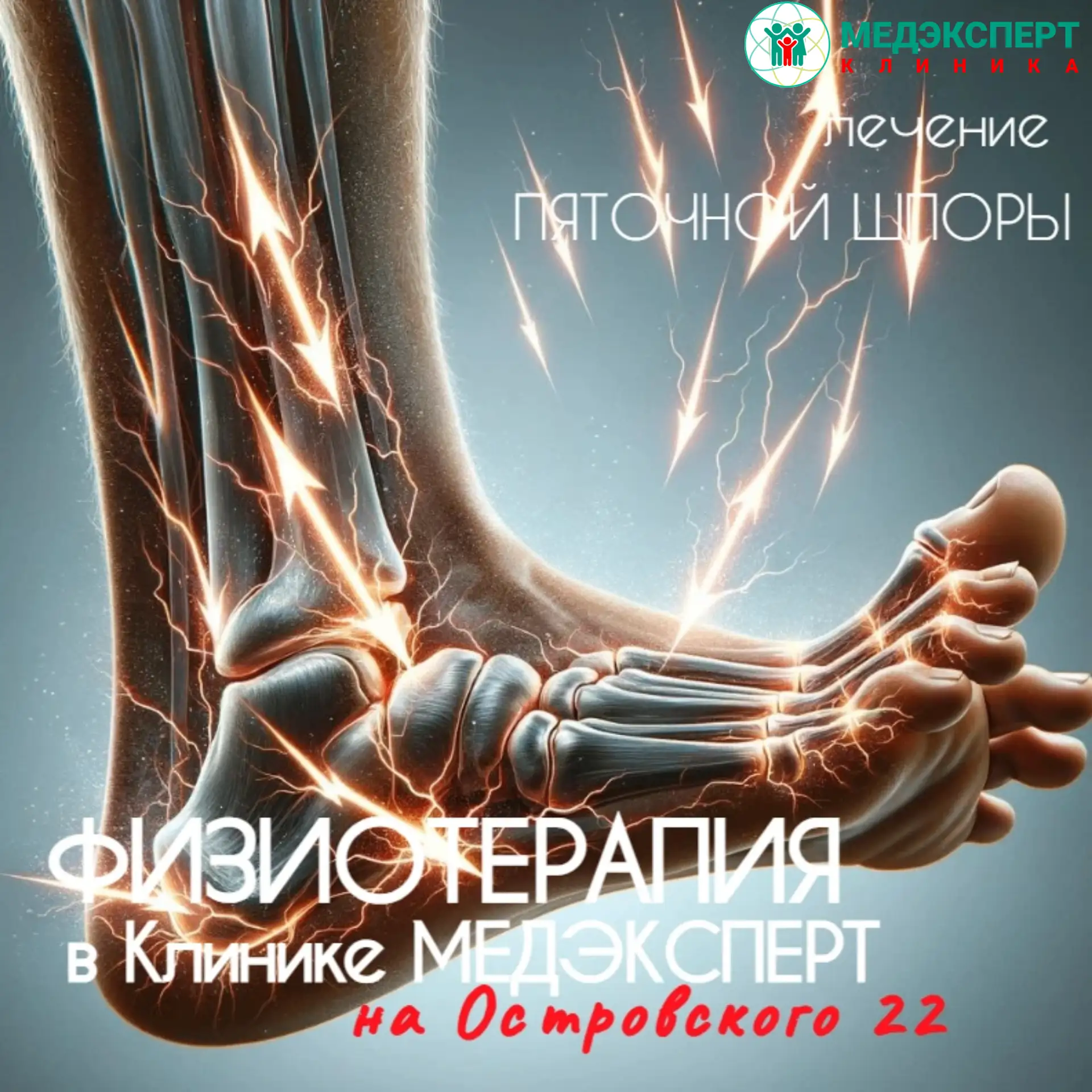 💡 Как лечат пяточную шпору в Клинике МЕДЭКСПЕРТ: без спешки и без лишних процедур