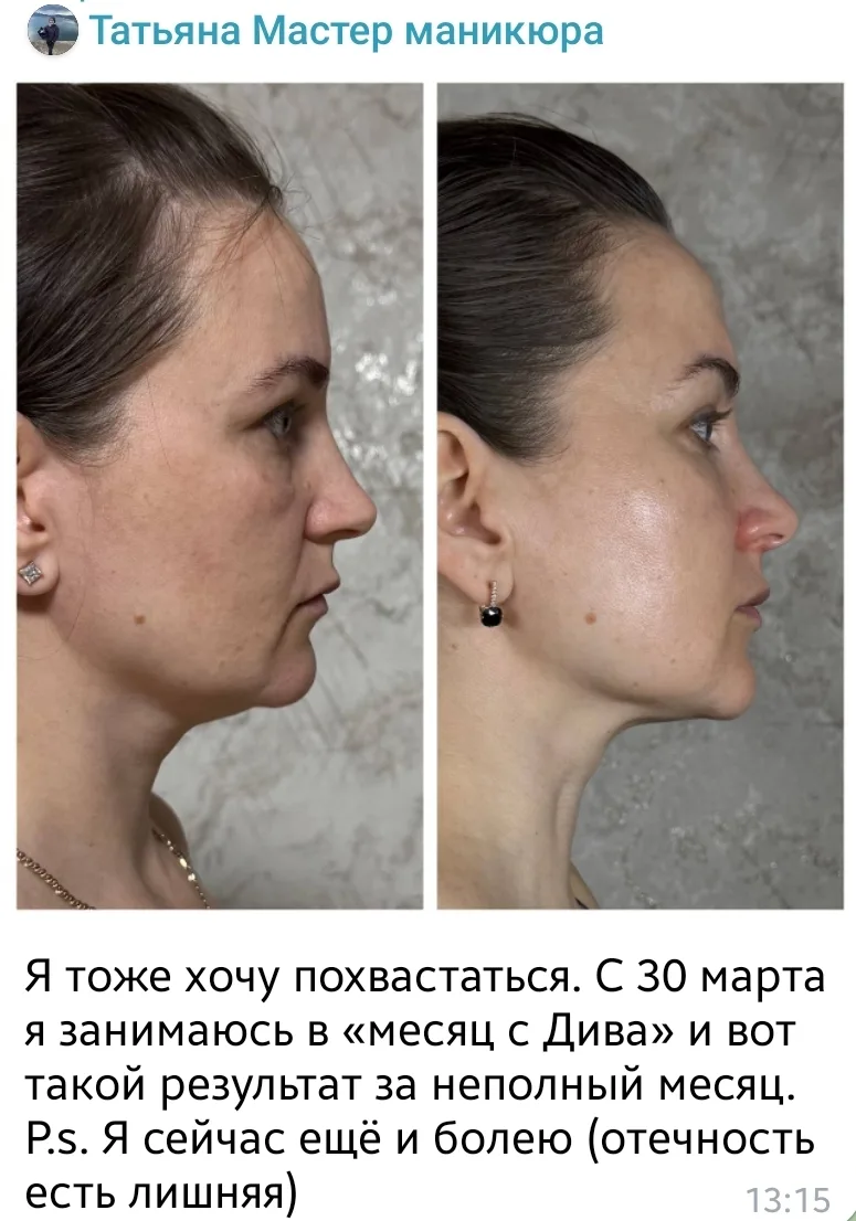 Смотрите, какой результат можно получить за 4 недели занятий ⬆️  Это просто 😍🔥 Как подтянулся овал  