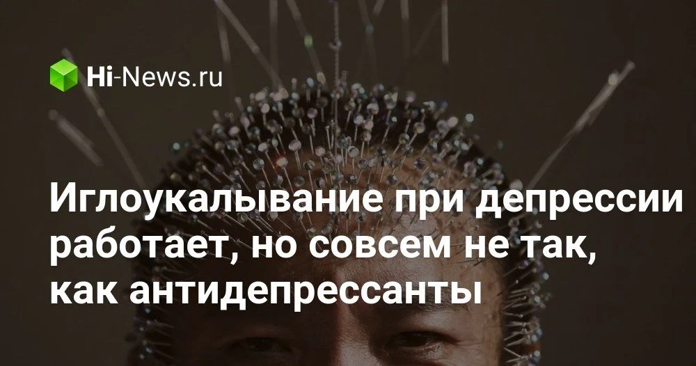 Иглоукалывание при депрессии: что показывают снимки мозга и почему это не просто эффект...