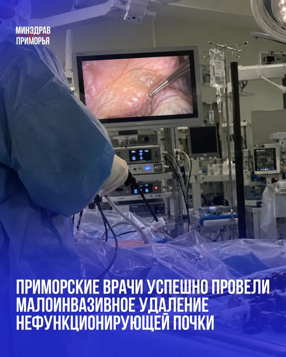 Во владивостокской клинической больнице №4 впервые выполнили лапароскопическую нефрэкто...
