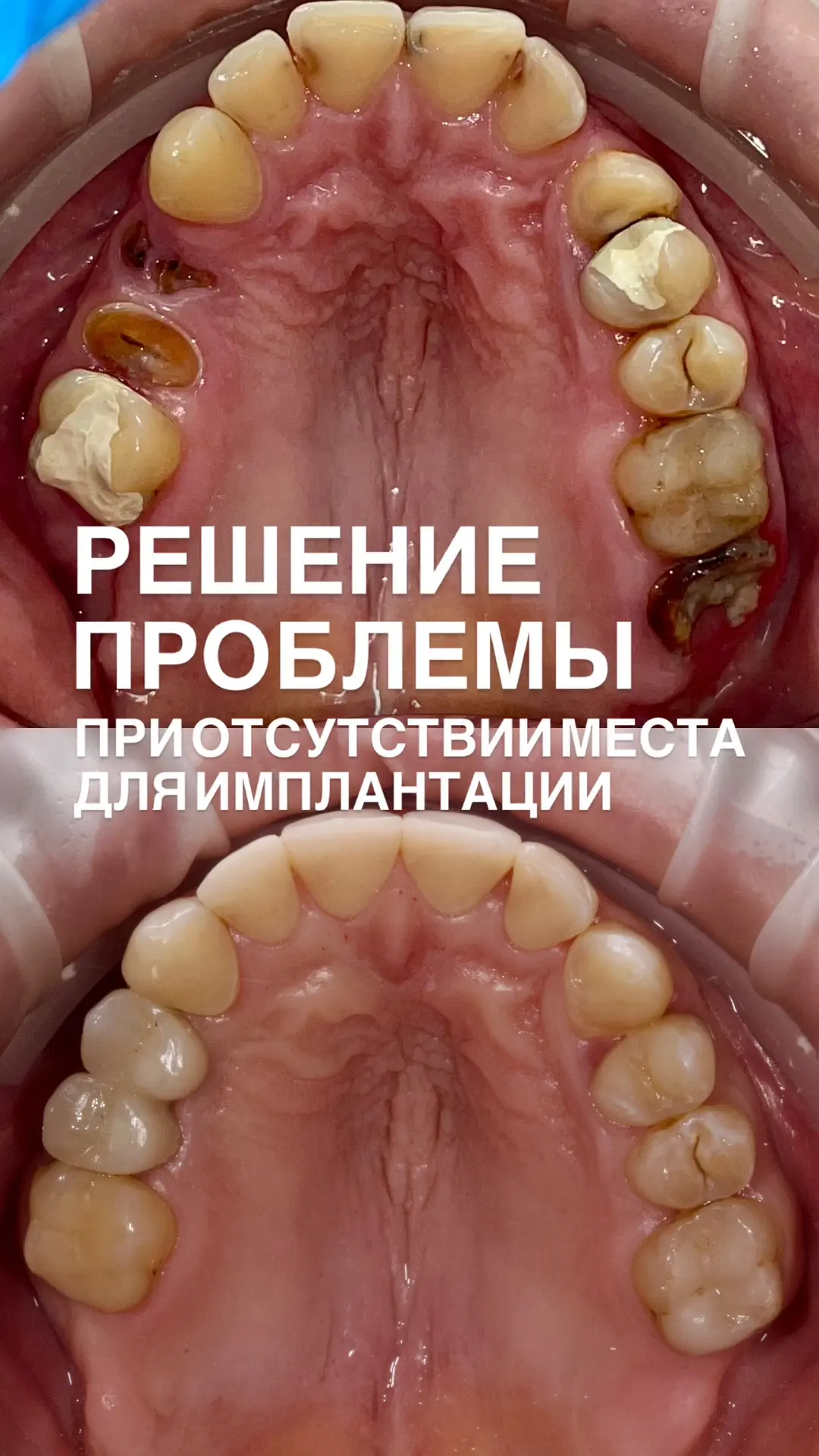 ВСЕ ОПИСАНИЕ КЛИНИЧЕСКОГО СЛУЧАЯ НАПИСАНО В ВИДЕО⬆️