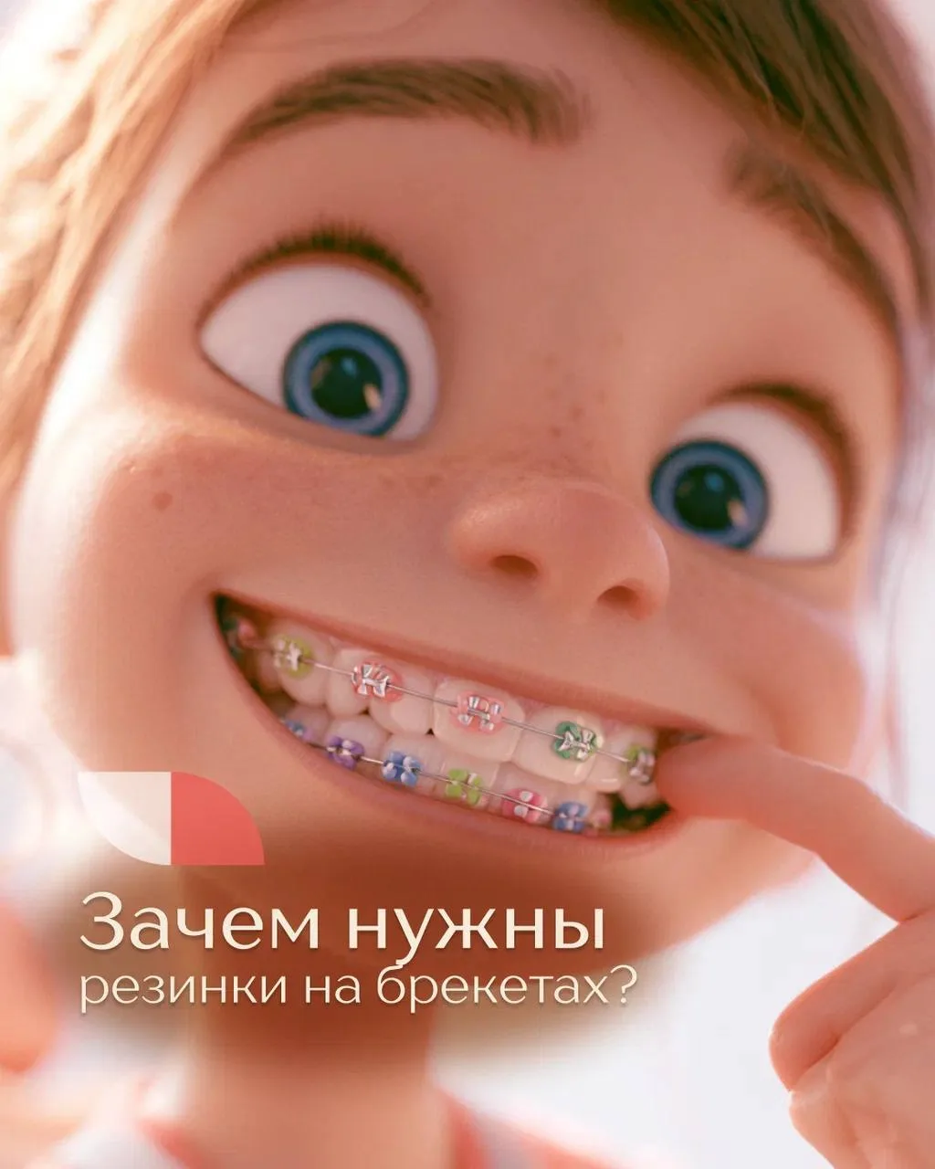 Что будет, если не носить резиночки, которые назначил врач-ортодонт? 👀