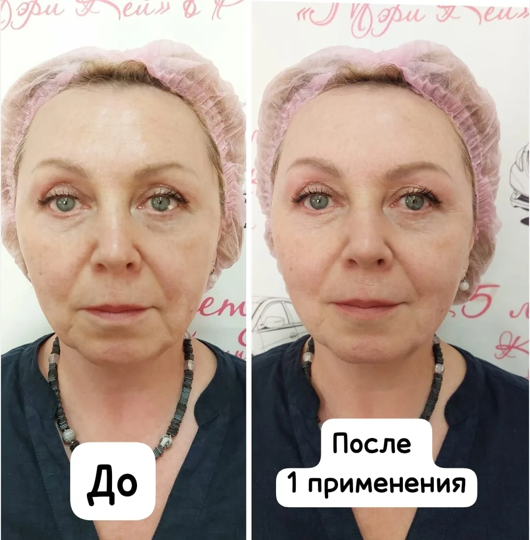 Приглашаю вас потестировать Аппараты по уходу за лицом😃