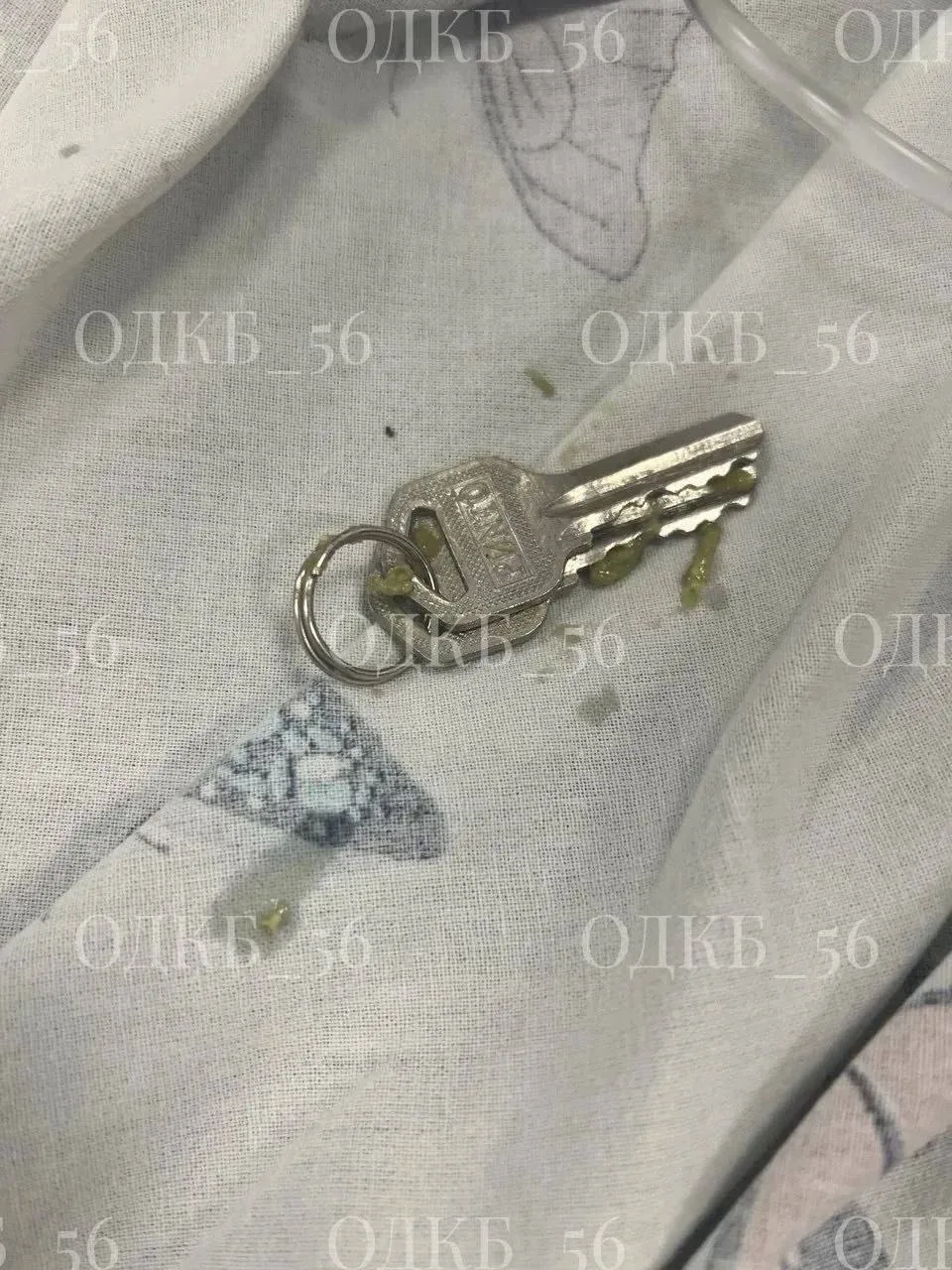 Оренбургские врачи снова извлекли инородное тело из желудка ребенка.  В областную больницу поступил 