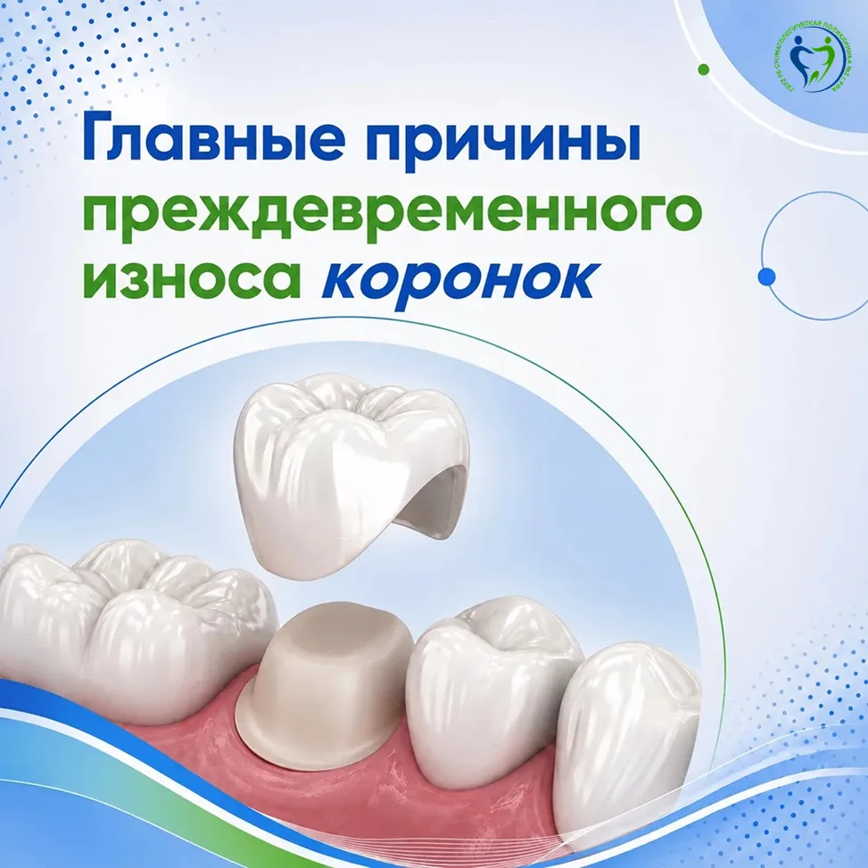 Почему коронка может прослужить 15-20 лет, а может всего 5 лет?