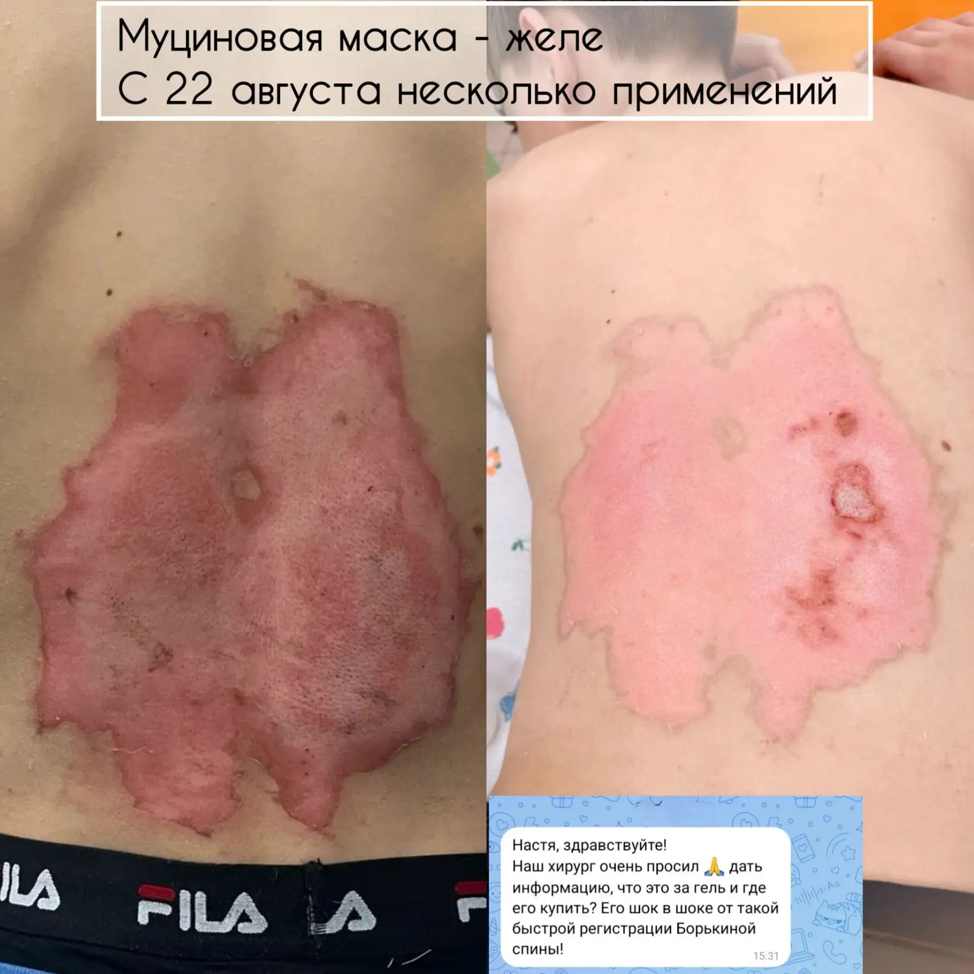 Коллега поделилась результатом своего клиента: 🥺🙏
