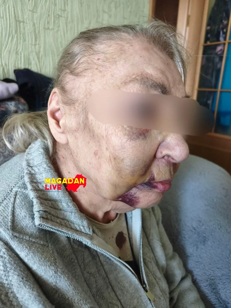К моей маме пришла сегодня знакомая 1946 г, р.Вот так её избивает сын которому 49 лет, ...