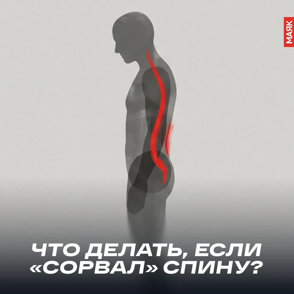 Поговорим о том, чего лучше бы избежать: что делать, если «сорвали спину»?