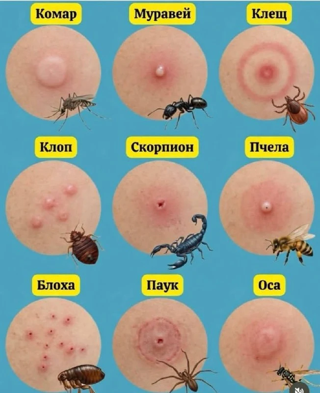 Понимание того, кто вас укусил, меняет то, что нужно делать.