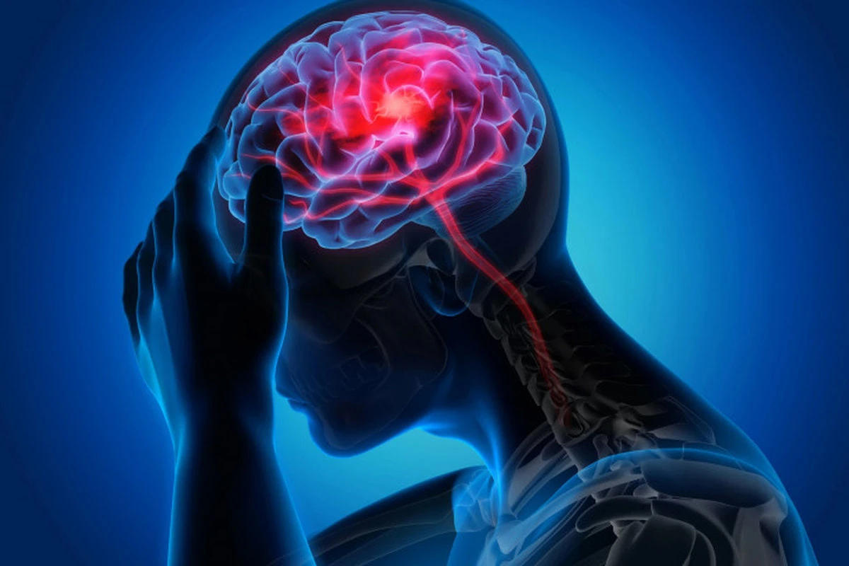 🧠Как в Беларуси помогают пациентам с инсультом и почему важно вовремя обратиться к врачу